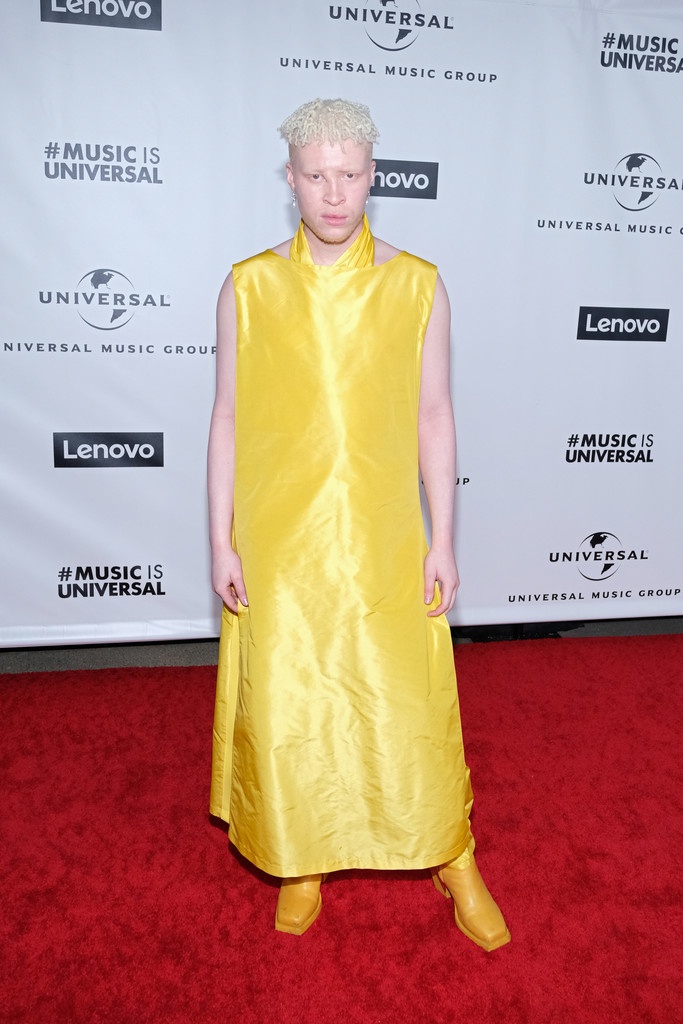 thời trang xấu nhất 2020 ảnh 2 thoi trang xau nhat 2020 anh 2