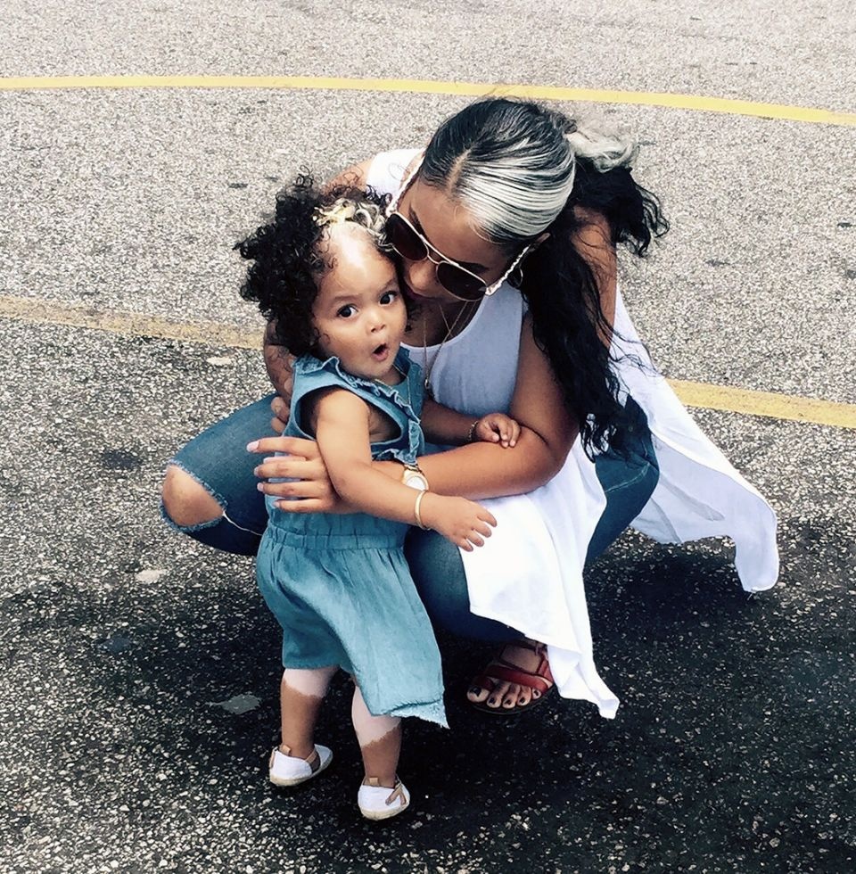 nguyen nhan co toc bac som anh 3