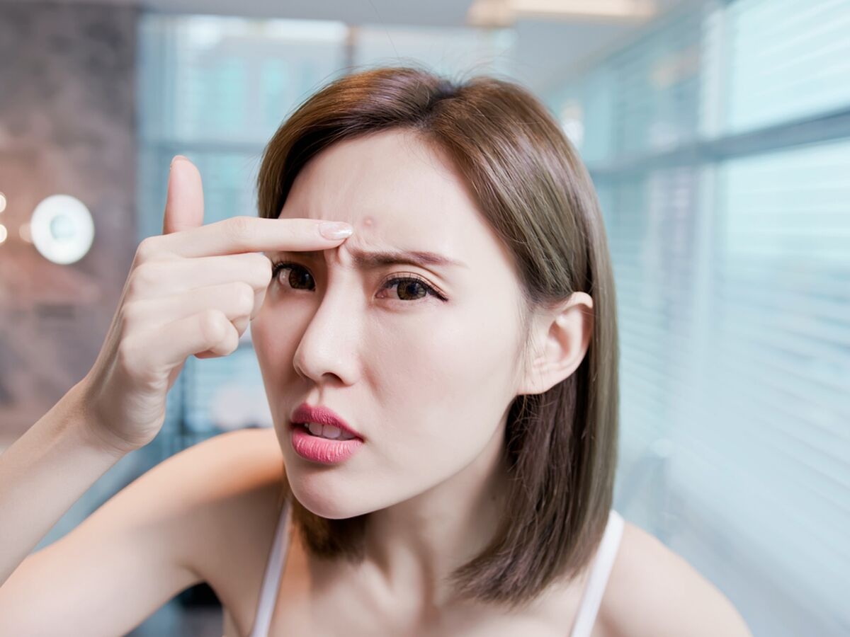 nguyen nhan noi mun anh 2