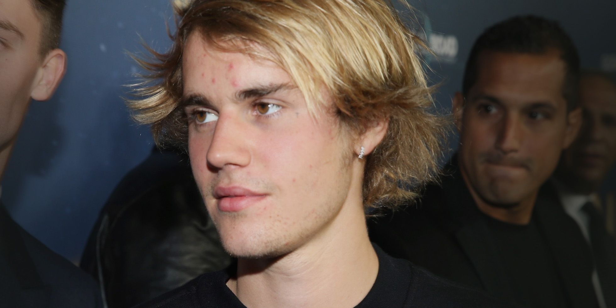 nam gioi nen lam gi de loai bo tham mun anh 2