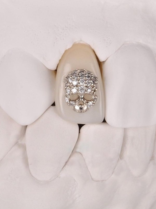 đính kim cương lên răng ảnh 2 dinh kim cuong len rang anh 2