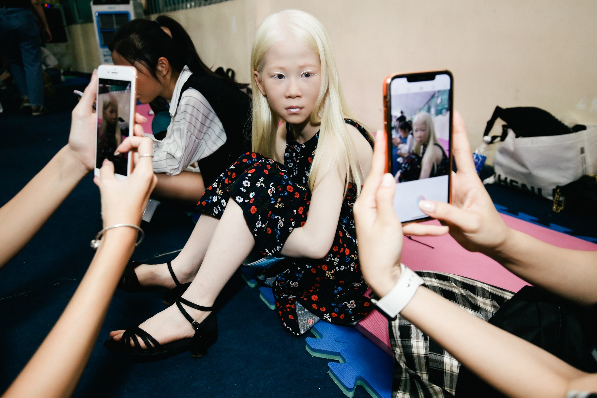 Mau nhi mac benh bach tang toa sang o tuan le thoi trang hinh anh