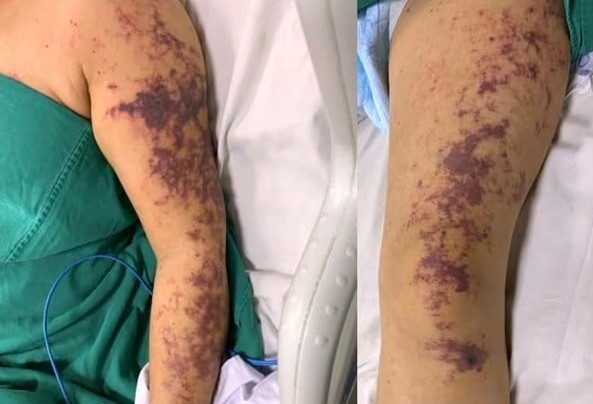 Nhung mon la o vi khuan nguoi Viet thich an vao dip Tet hinh anh