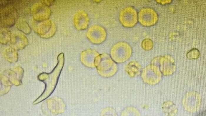 mon an nhieu vi khuan anh 1