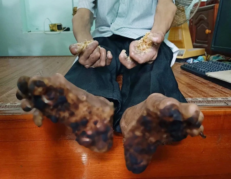 roi loan nhiem sac the anh 1