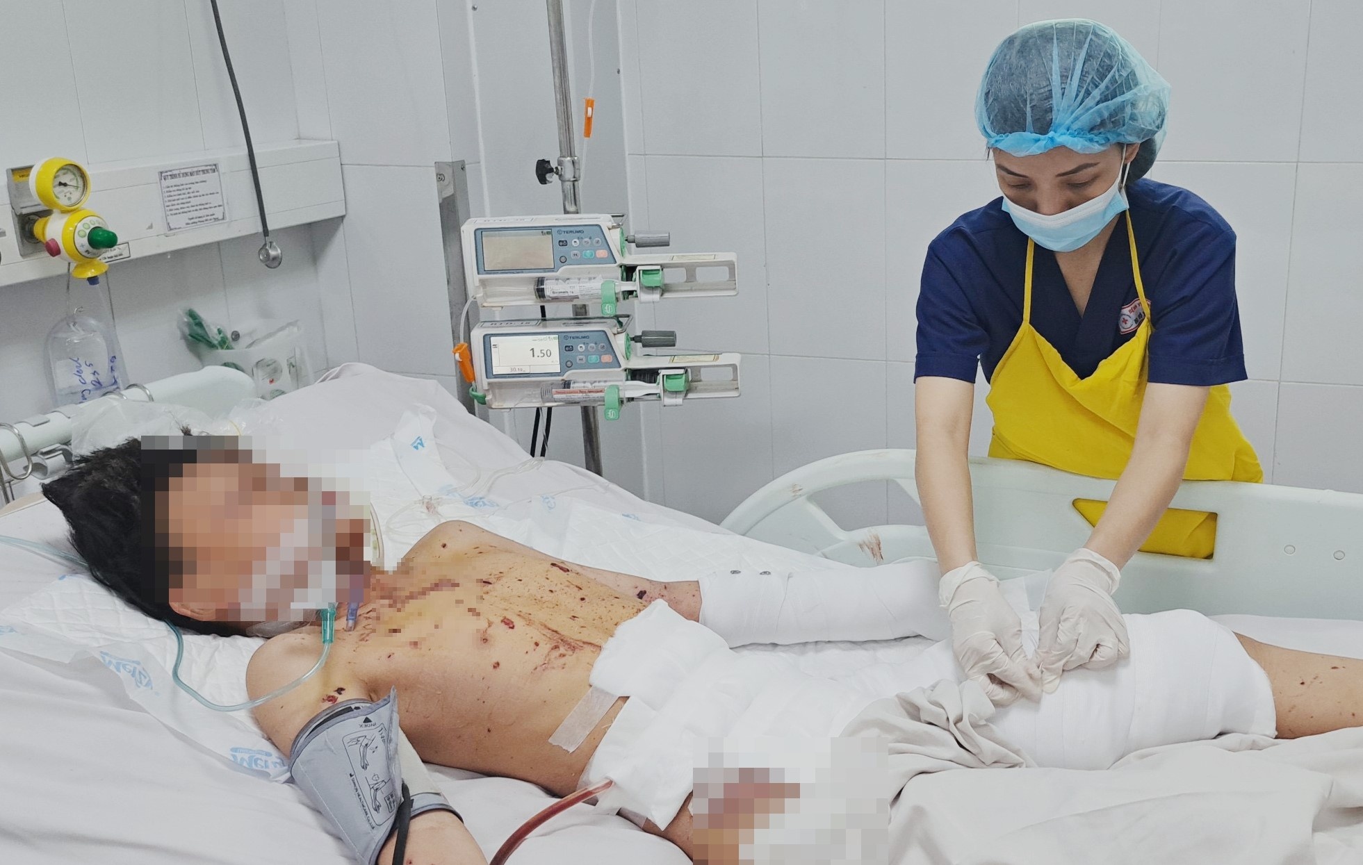 Be trai 12 tuoi chan thuong nang, lo noi tang vi choi phao hinh anh