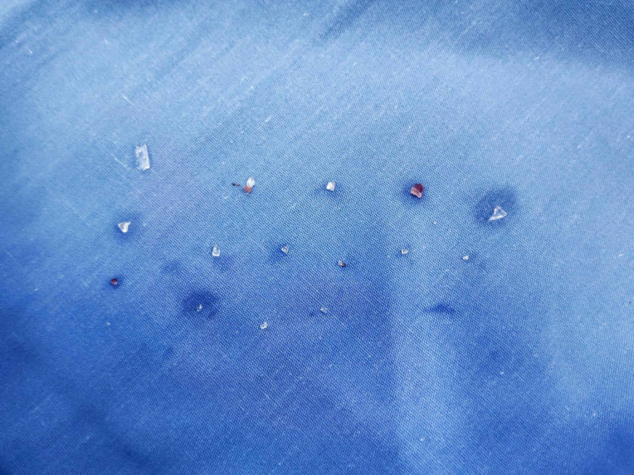 Bi 15 manh thuy tinh gam vao nguoi do choi phao hinh anh