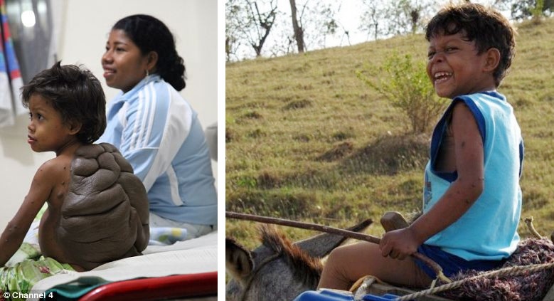 can benh hiem gap anh 2