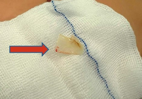 hoc xuong ca loc anh 1