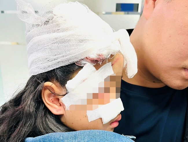 bi dai vi cho can anh 1