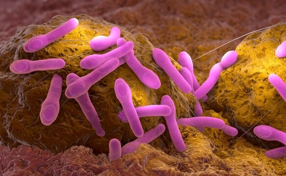 Hai tre o TP.HCM nghi ngo doc Botulinum sau bua an tat nien hinh anh