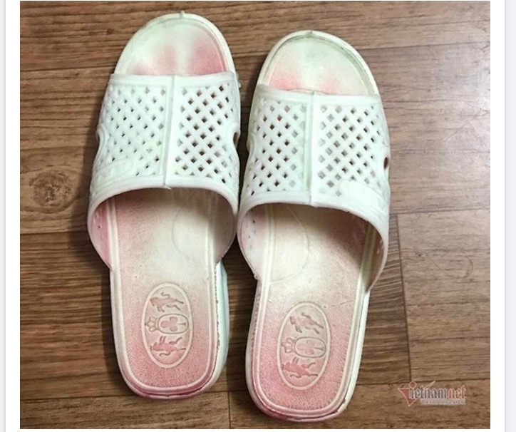 benh mo hoi mau anh 1