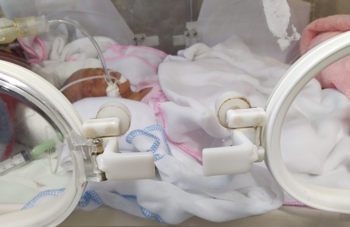 Benh vien tinh nuoi song duoc tre sinh non 900 gram hinh anh