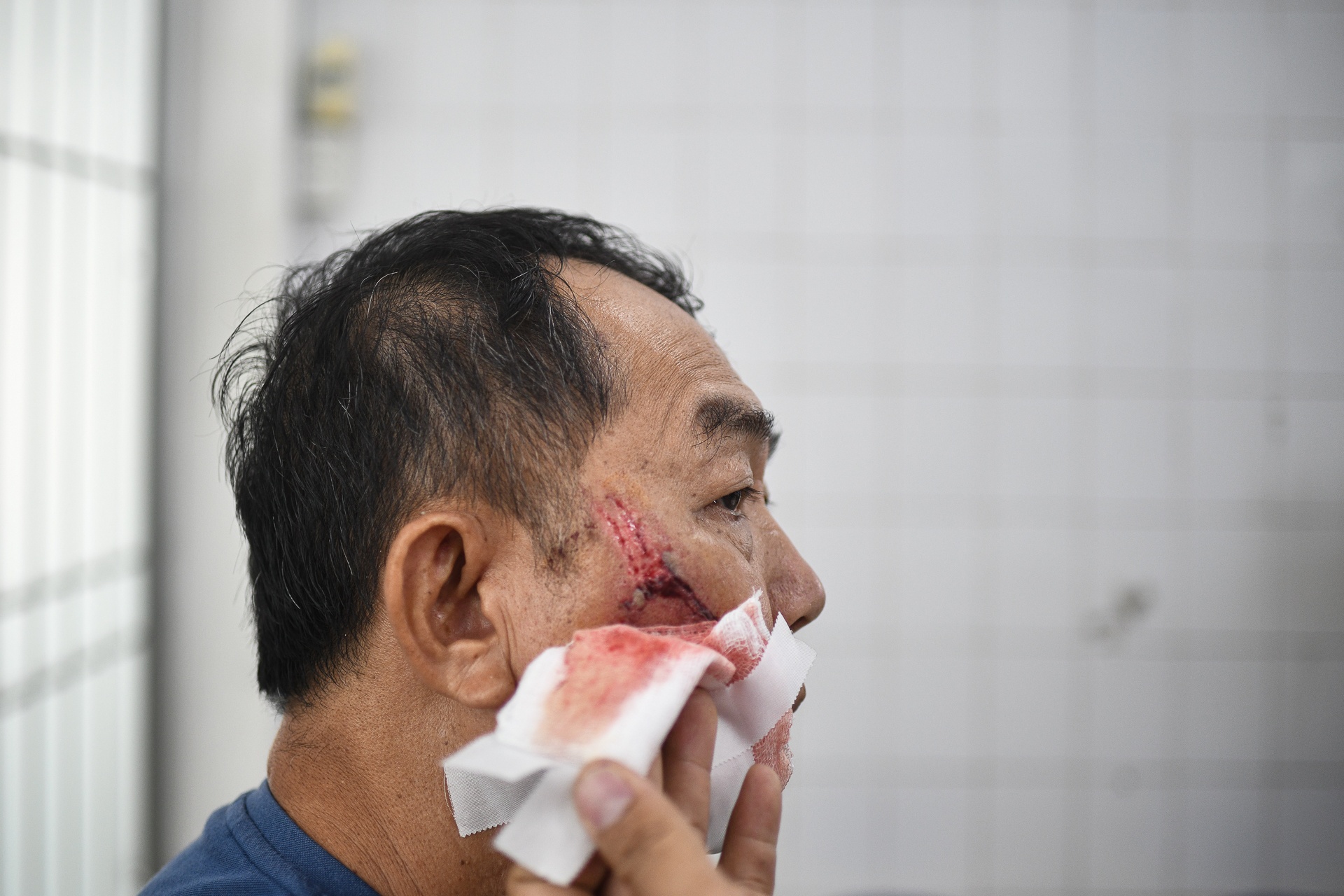 tiem vaccine dai tang cao anh 2