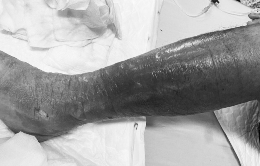 Hoai tu da thit trong mot ngay vi di chan tran loi nuoc hinh anh