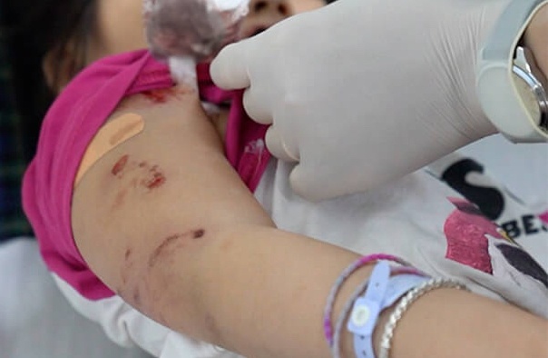 Be gai 5 tuoi bi cho tha rong can toi tap hinh anh