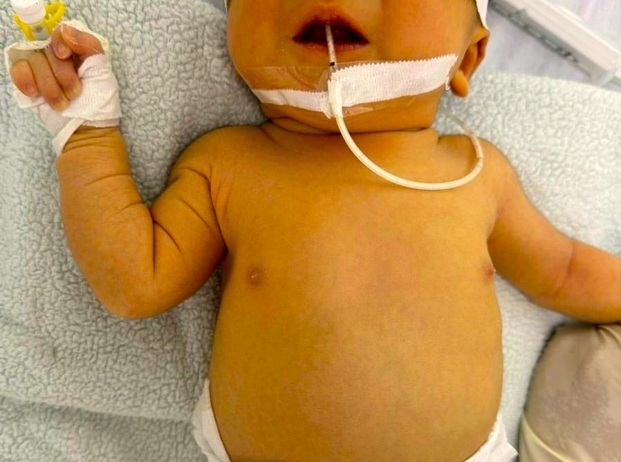 Can benh khien em be phai thay mau khi vua sinh 3 ngay hinh anh