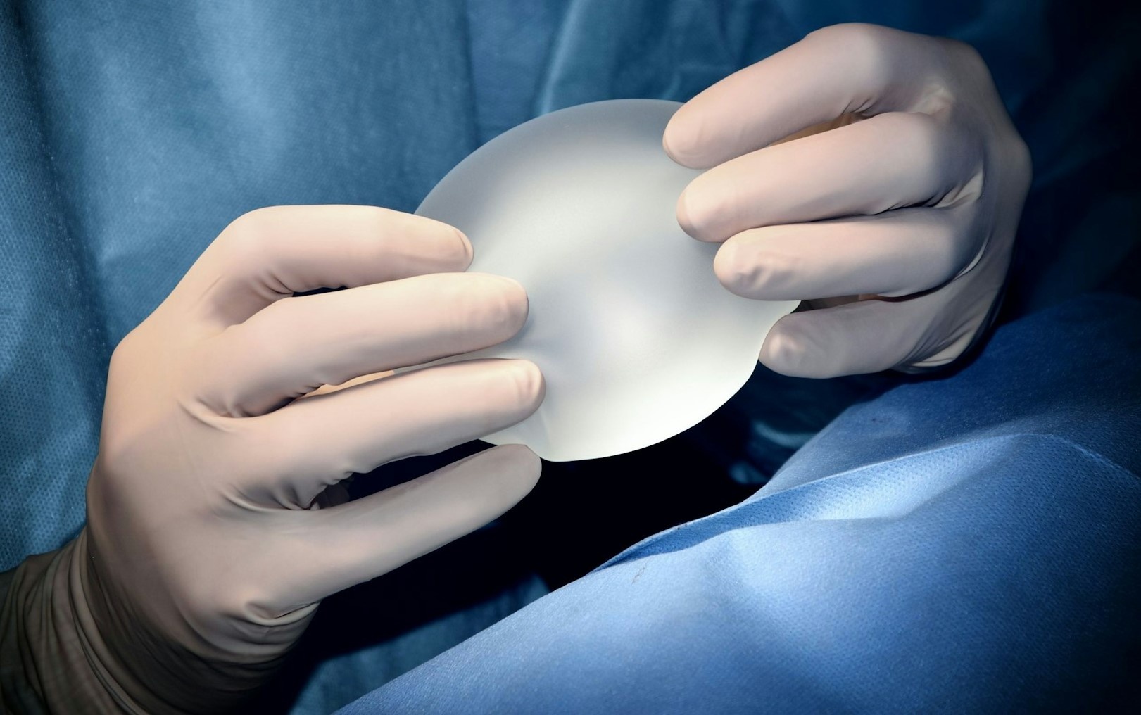 Ai khong thich hop de phau thuat tham my? hinh anh