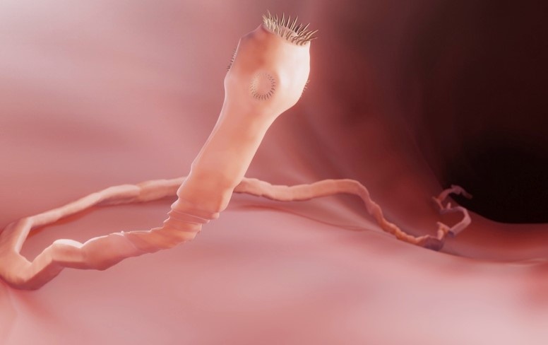 Hang chuc con giun dua ngoe nguay trong bung be trai hinh anh