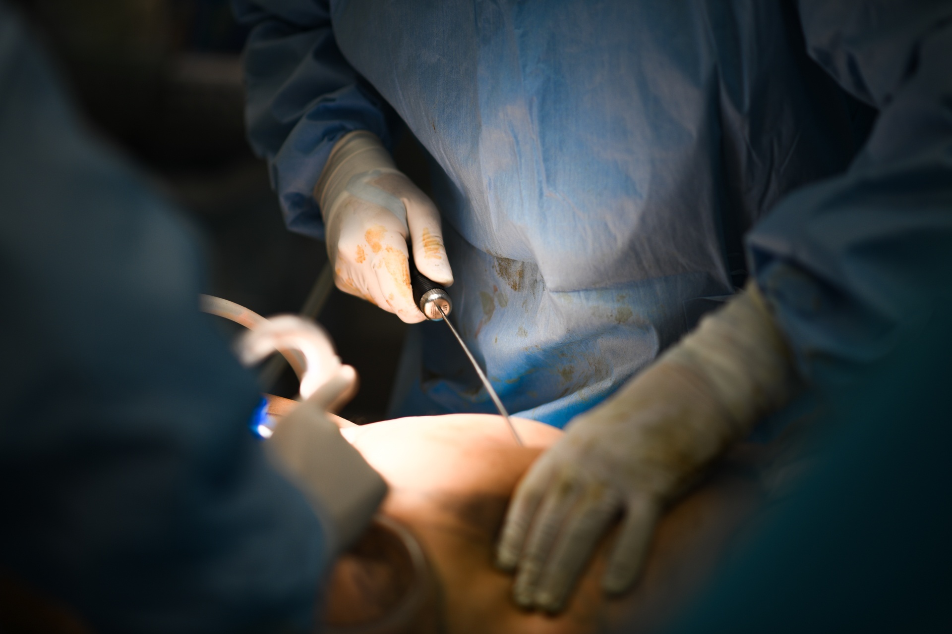 Nu Viet kieu tu vong sau khi tham my tai Benh vien Tan Hung hinh anh