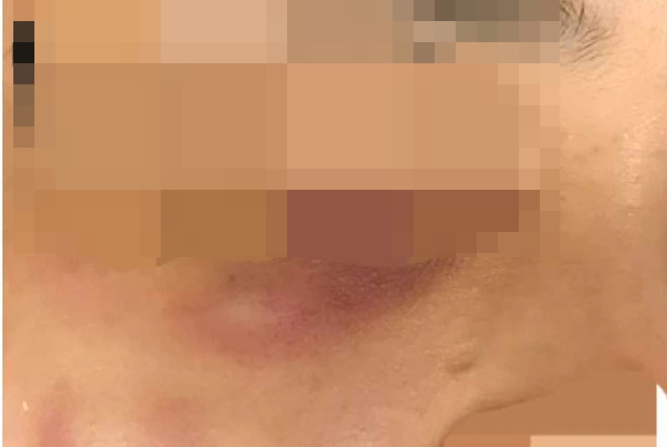 Chu co so spa tiem 'nham' sua rua mat vao da cho khach hinh anh