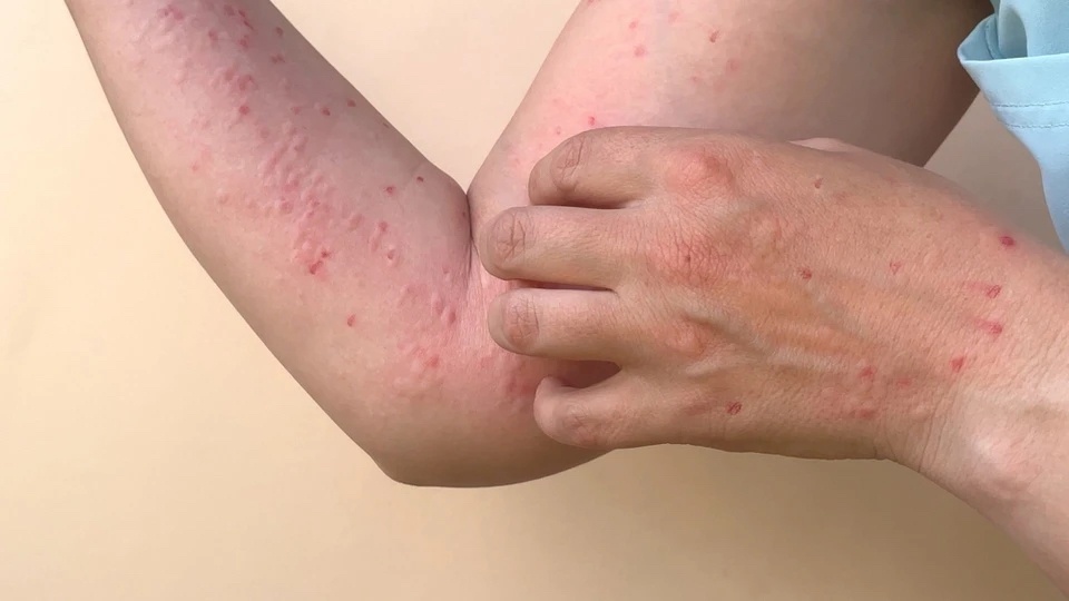 Thanh nien 28 tuoi o Dong Nai mac dau mua khi hinh anh