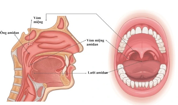 dieu tri viem VA anh 1