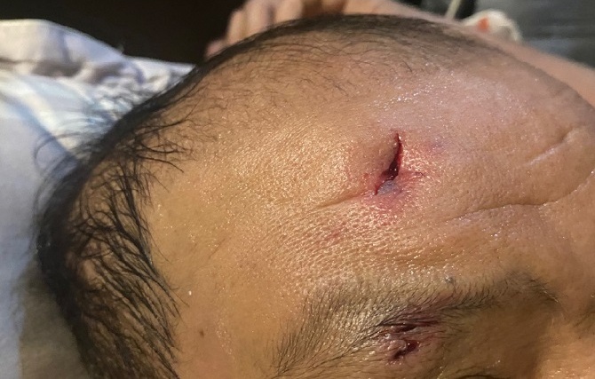 Cho dai nang 15 kg tan cong nhieu nguoi o Ha Noi hinh anh