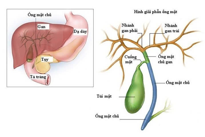 ung thu ong mat anh 1