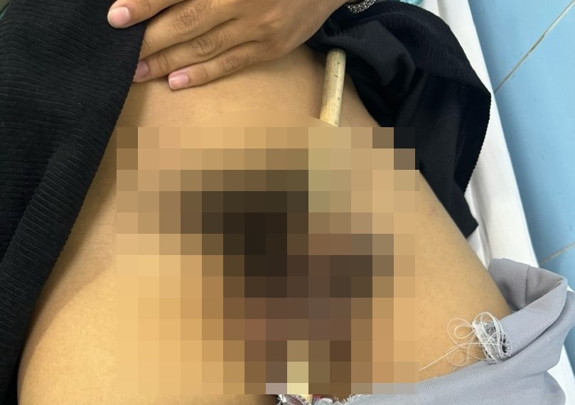 tai nạn hy hữu ảnh 1 tai nan hy huu anh 1