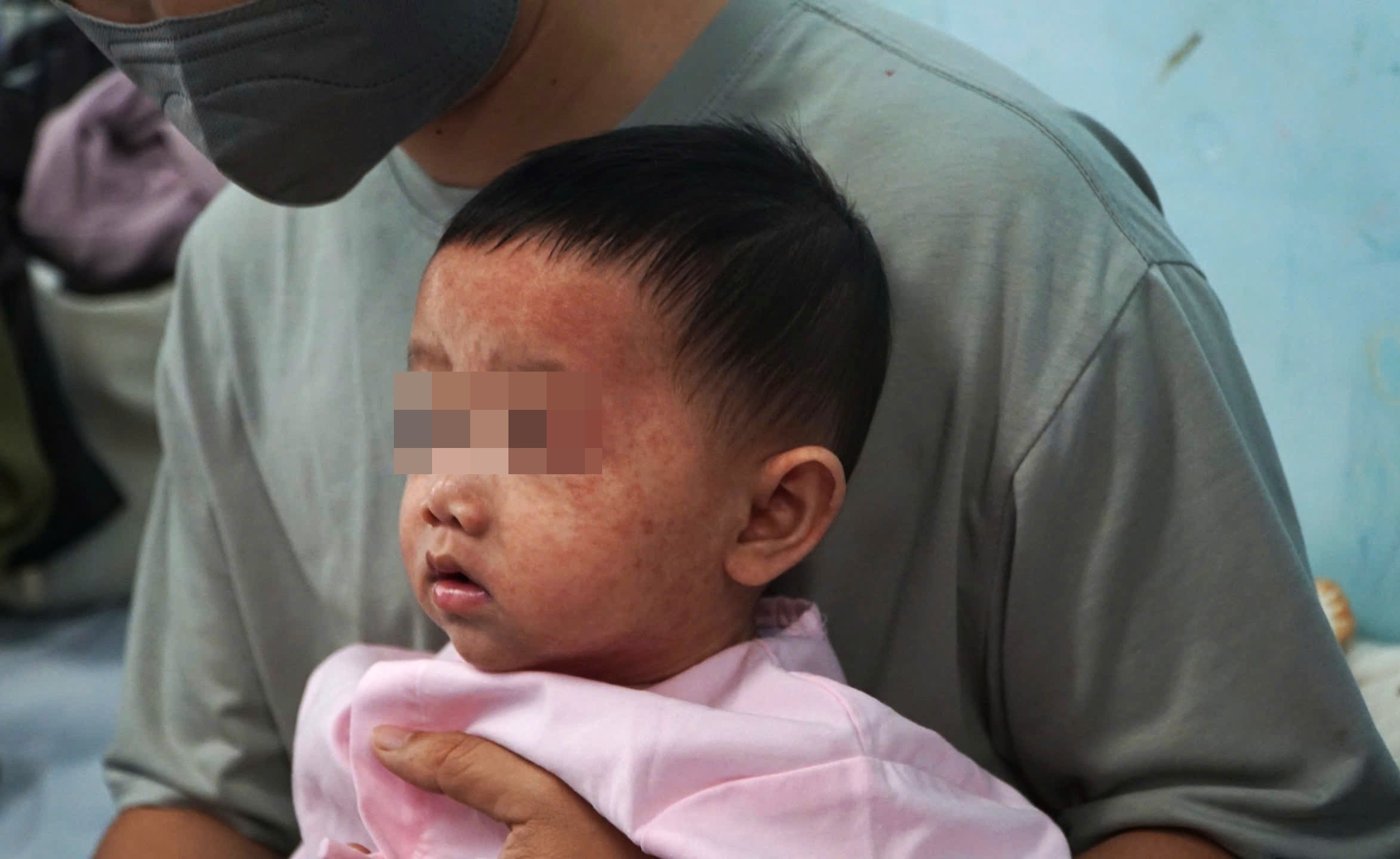 So ca mac soi tai TP.HCM tang don dap hinh anh