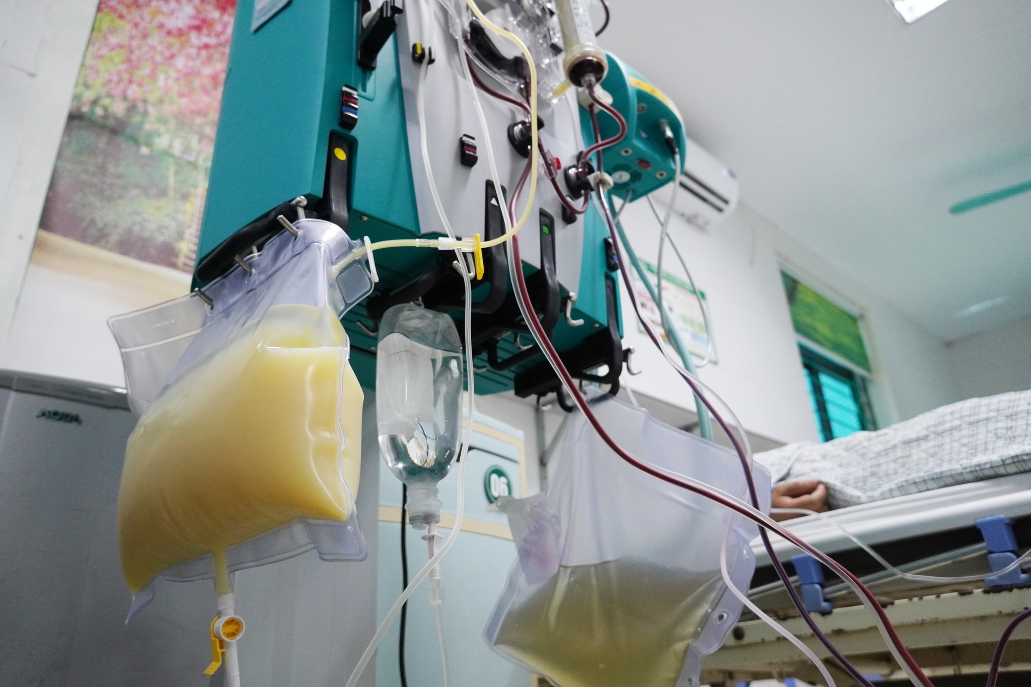 Can benh khien nguoi dan ong nhap vien dau don, mau duc nhu sua hinh anh