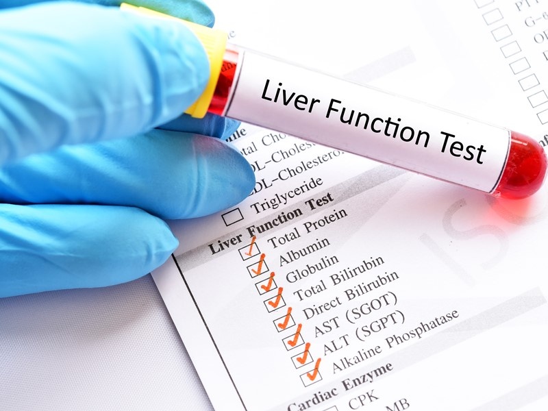 Nhin vao mat, phat hien dau hieu ung thu gan hinh anh