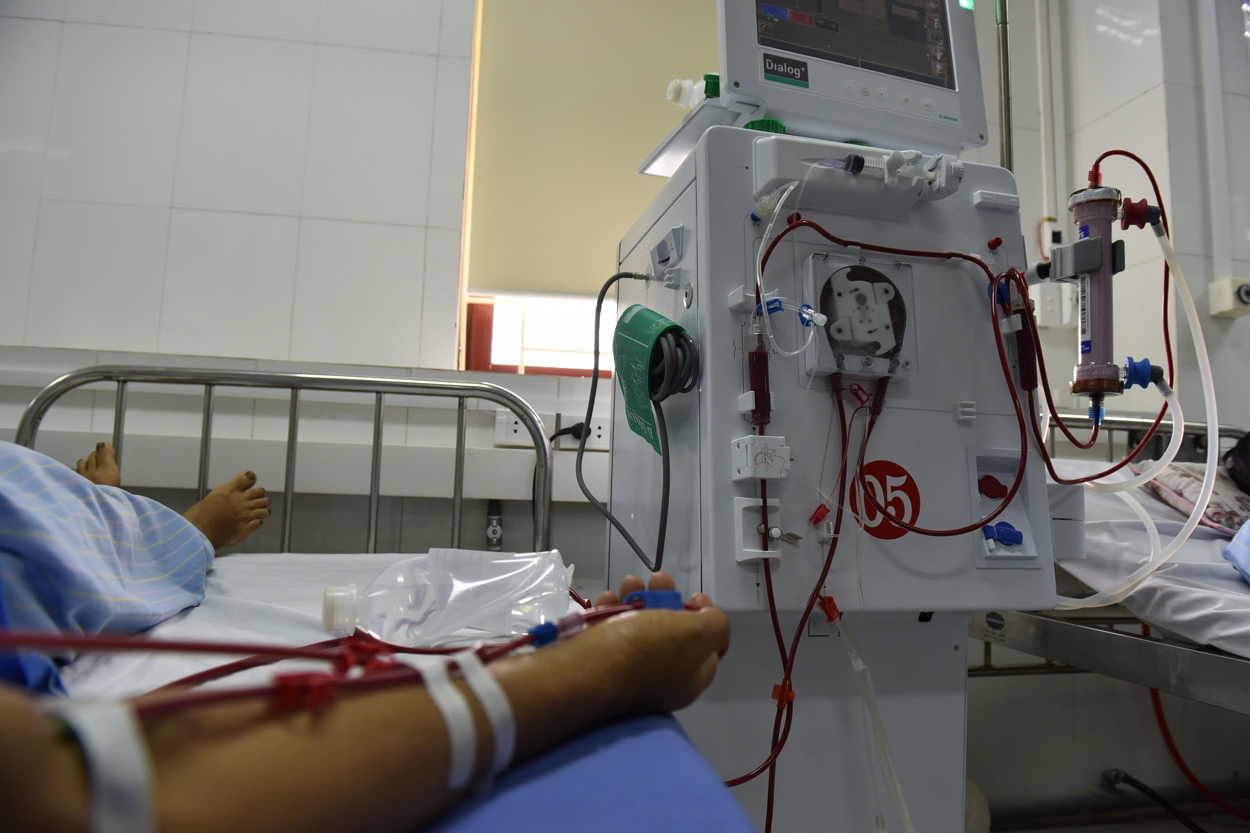 Suy than o tuoi doi muoi vi loi song nhieu ban tre mac phai hinh anh