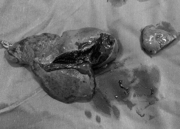 Nguoi dan ong nga vo lach trong luc don nha sau bao Yagi hinh anh