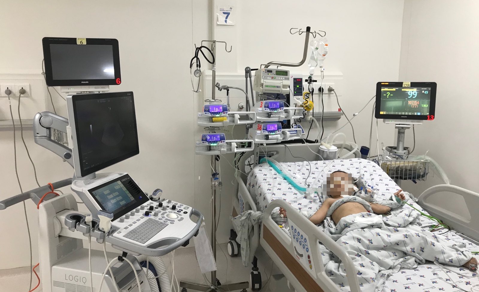 Be trai dau bung khong ngung, di vien phat hien vat la trong ruot hinh anh