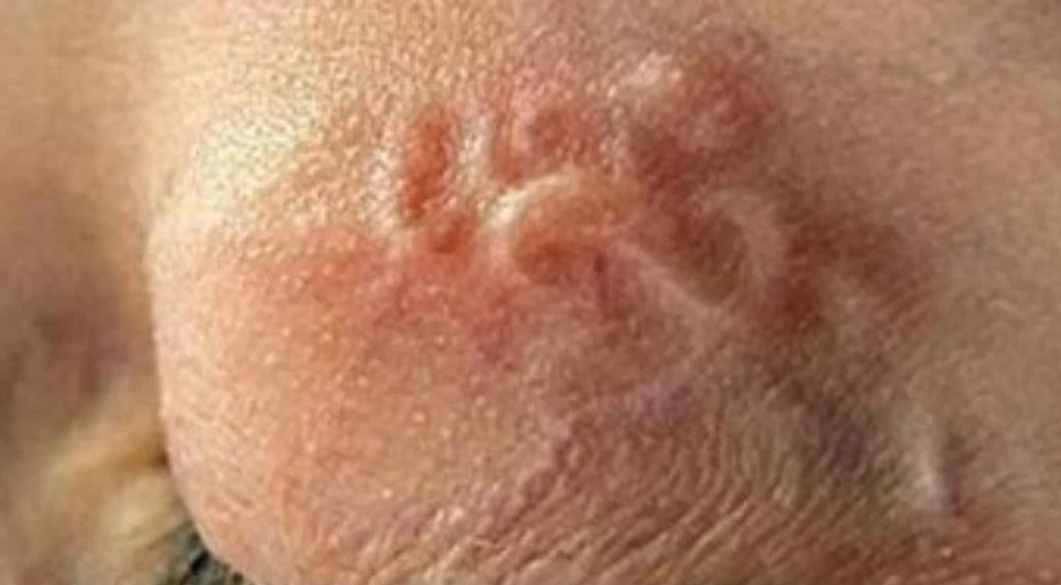 Nhiem san cho la gi? hinh anh