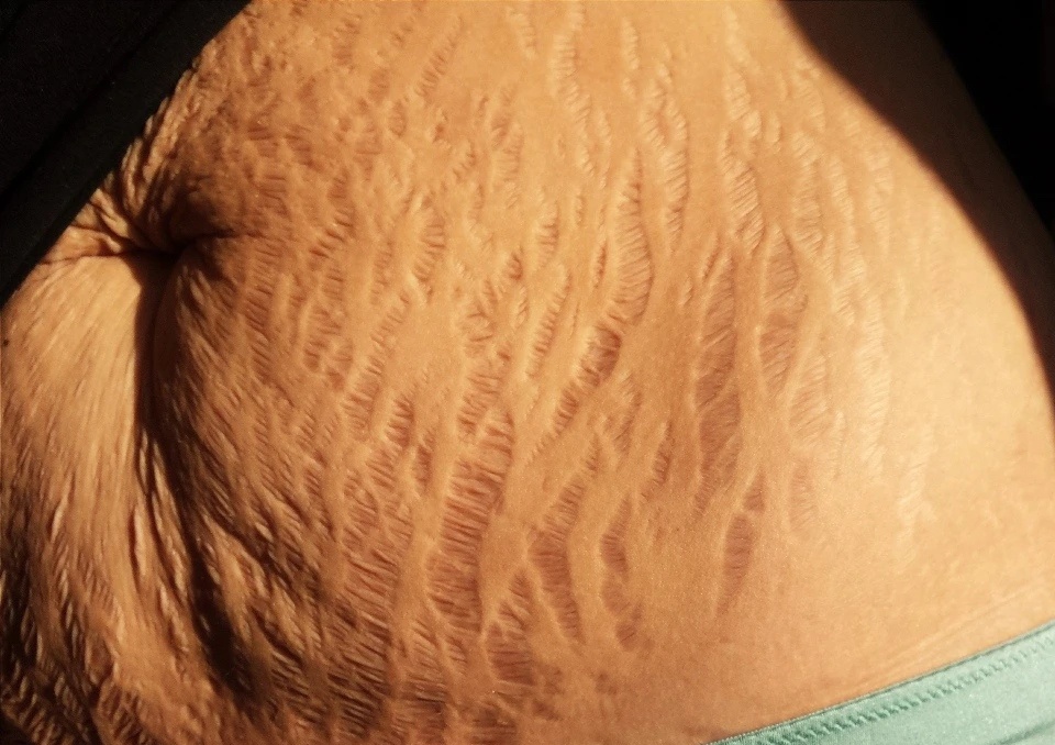 Cau chuyen xuc dong sau hinh anh da ran khi mang thai hinh anh