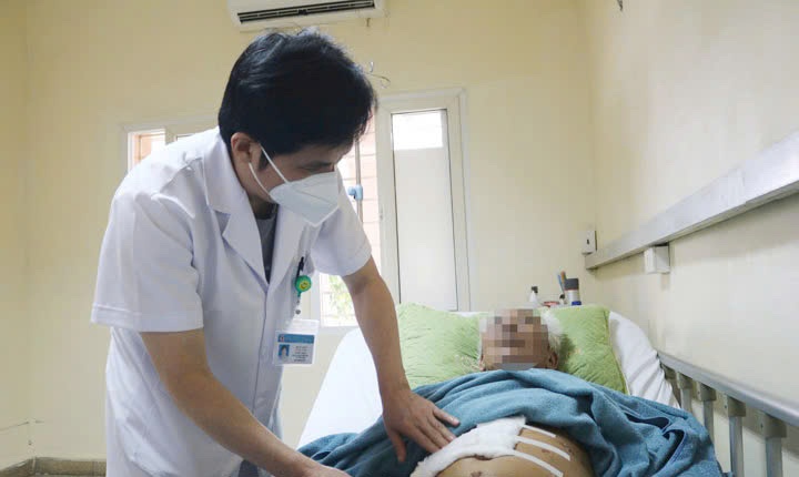 ung thu gan anh 1