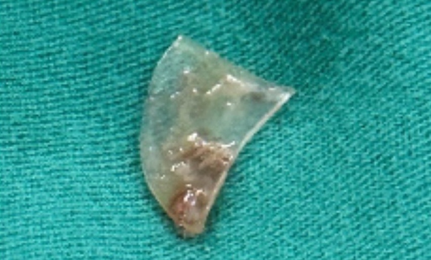 Be gai o TP.HCM kho tho suot 4 thang, gia dinh bat ngo khi biet ly do hinh anh