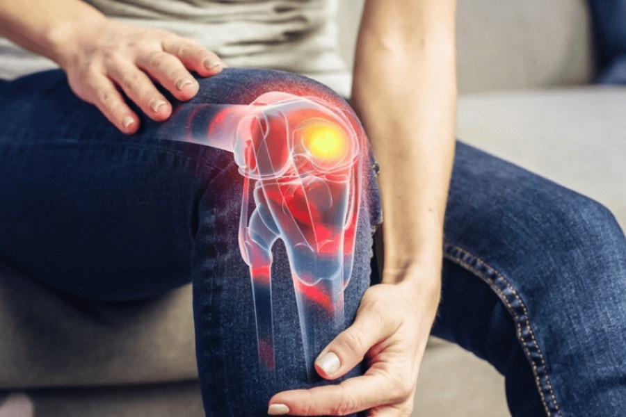 Dieu tri cung khop hinh anh