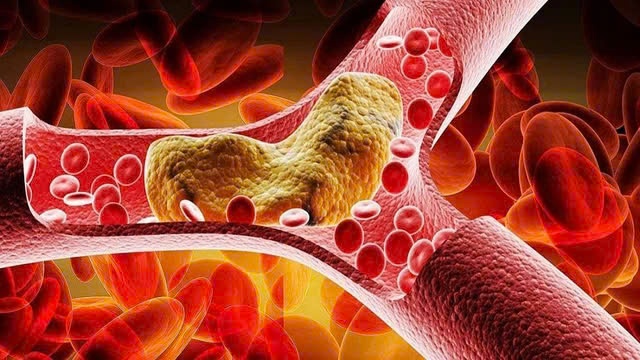 Cach kiem soat de mo mau khong cao hinh anh