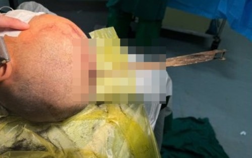 Nam sinh bi luoi dao cam sau vao so nao hinh anh