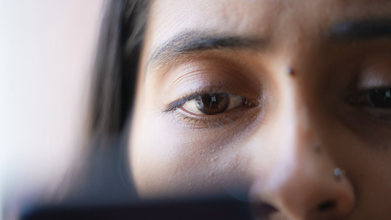 Cach nao phong ngua kho mat? hinh anh