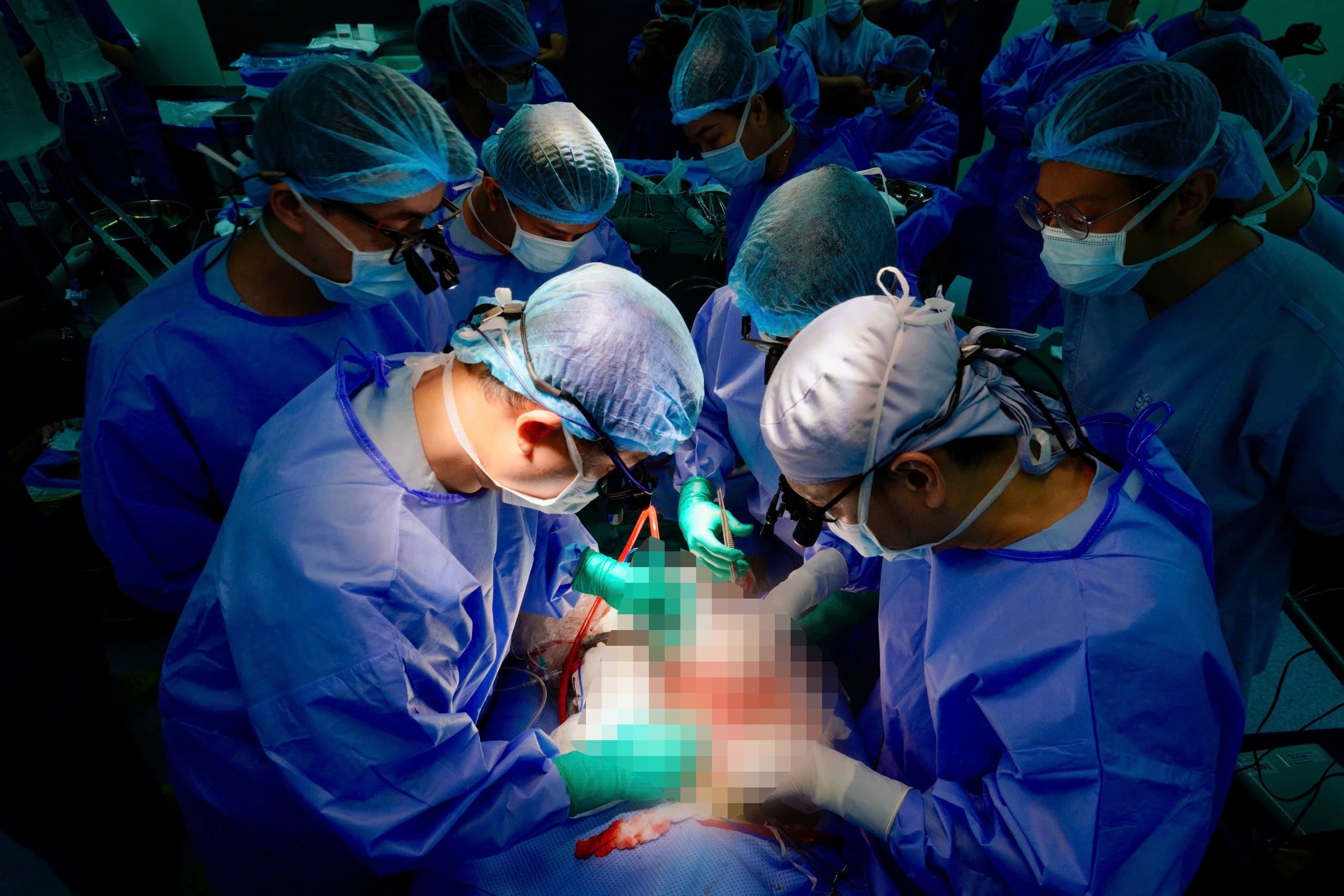 lay va ghep tang anh 3