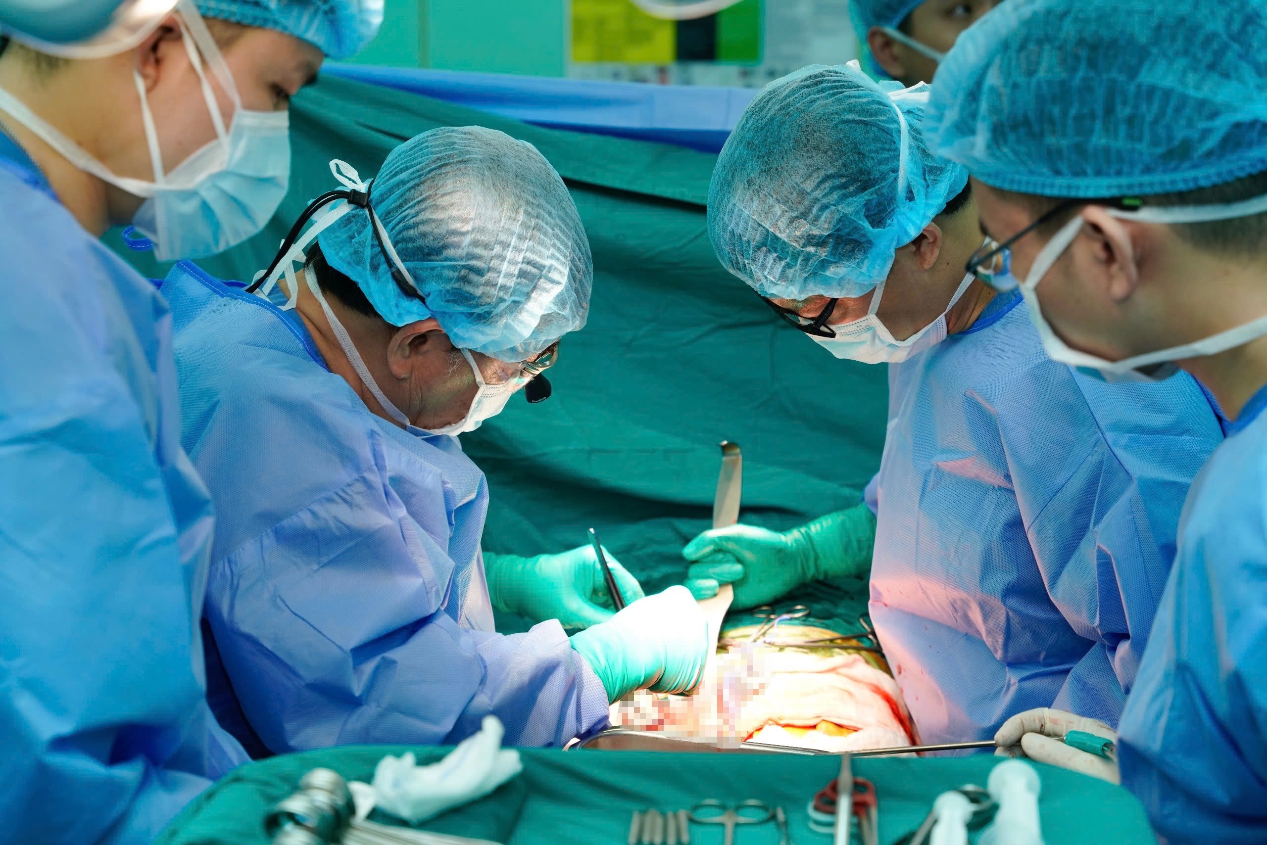 lay va ghep tang anh 5