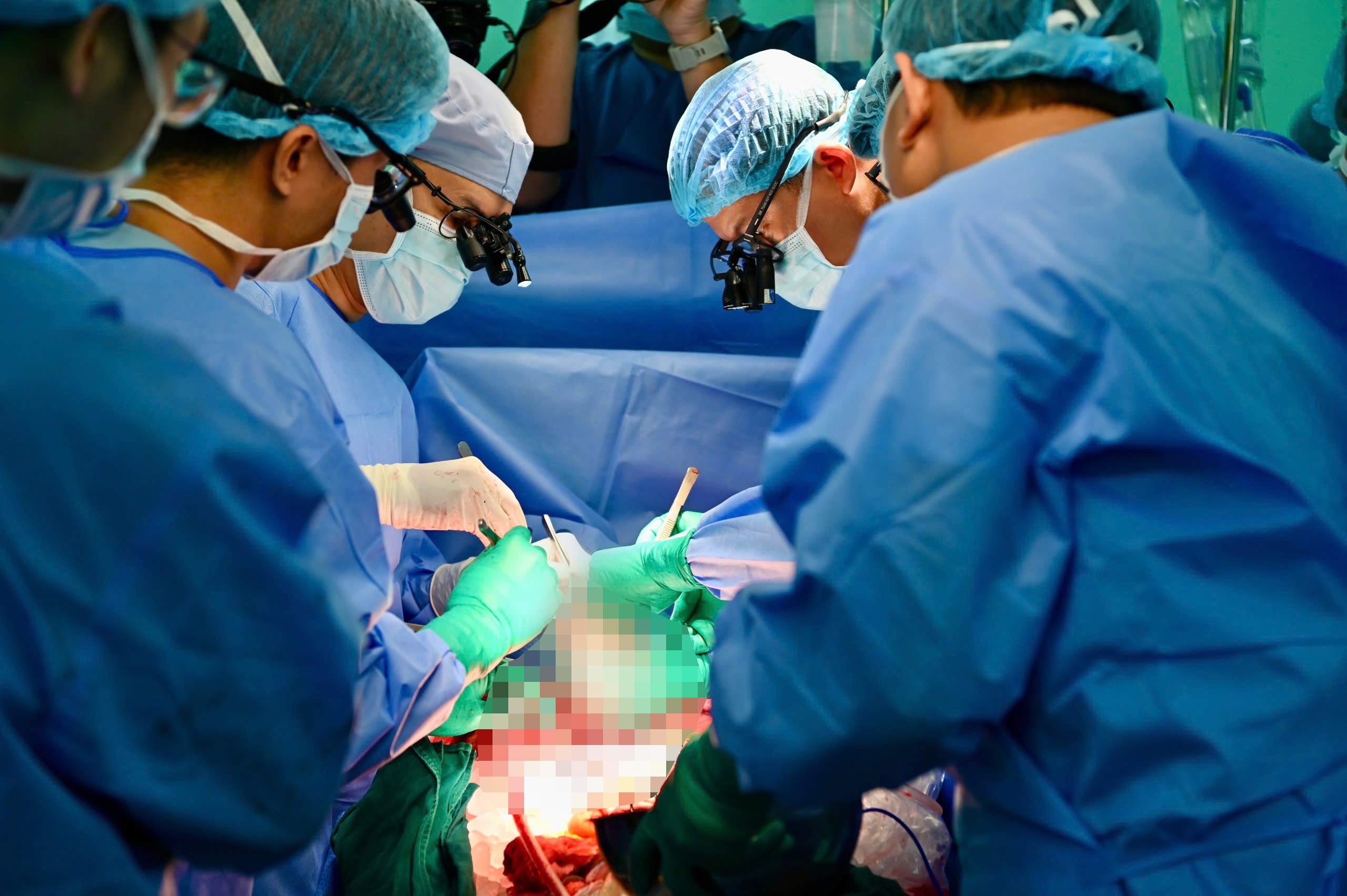 lay va ghep tang anh 2