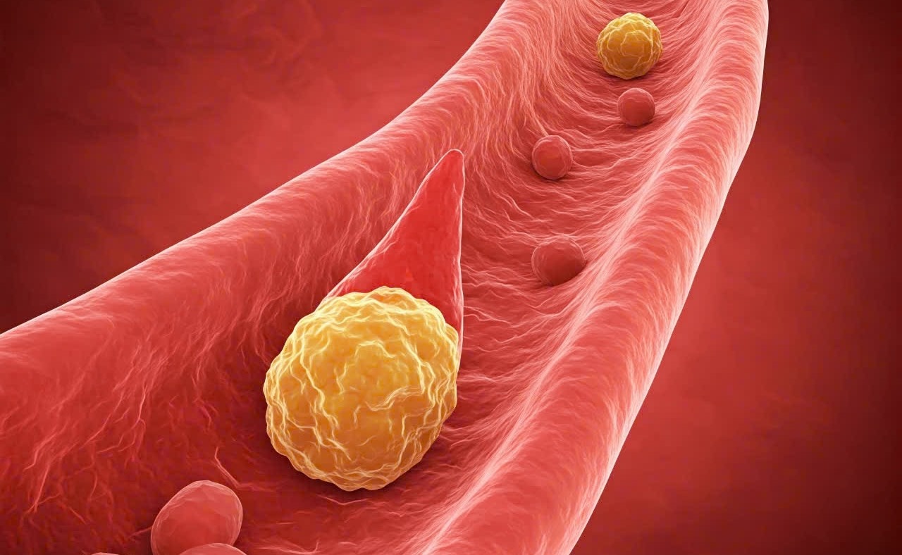 Can benh roi loan mo mau co the de doa tinh mang hinh anh