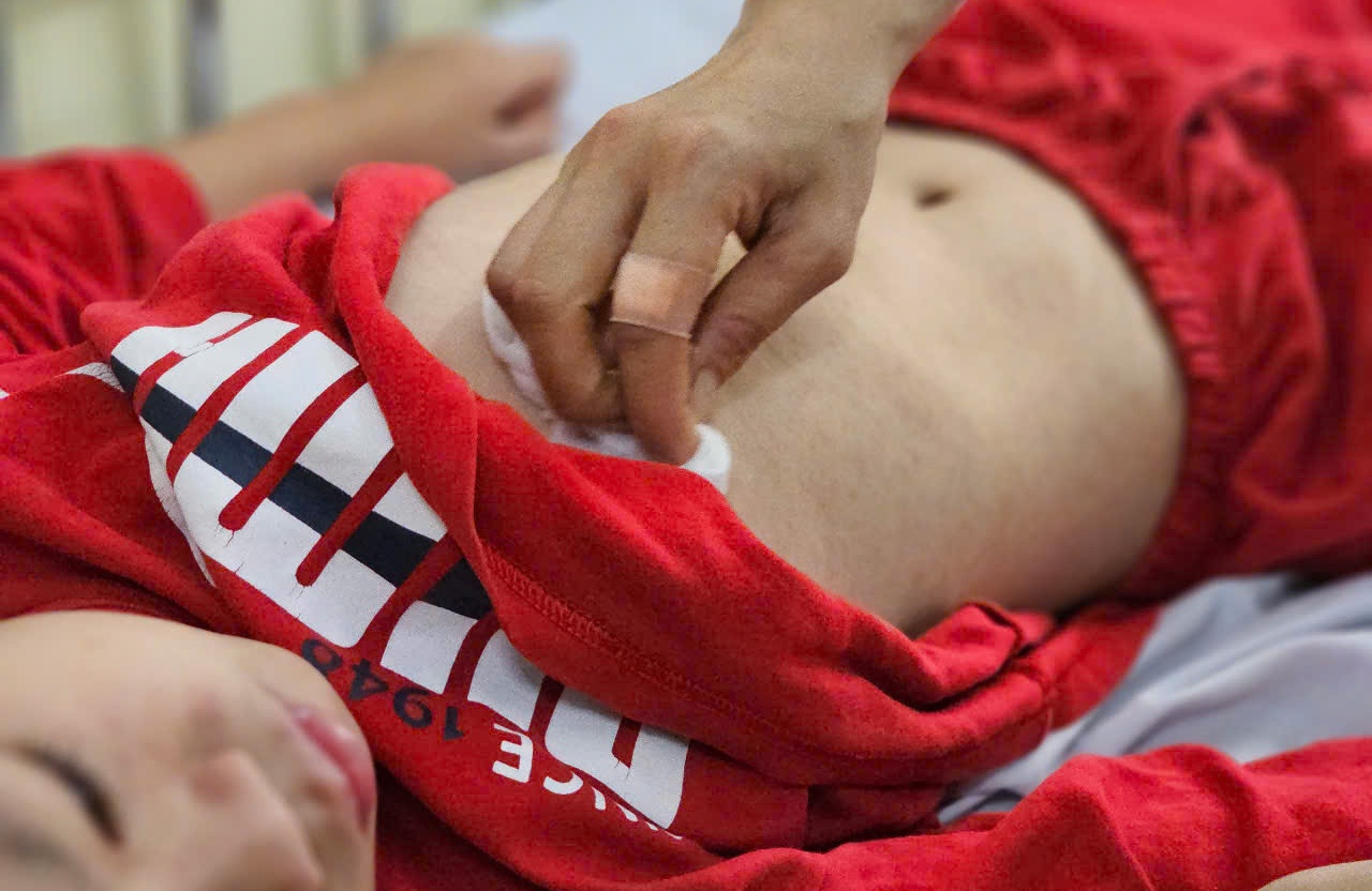 Nguoi tiep xuc voi benh nhan soi nen lam gi? hinh anh