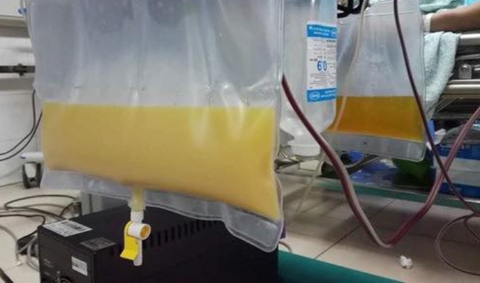 'Thanh nhau' trach bac si 'chu cu doa anh' de roi phai di cap cuu hinh anh